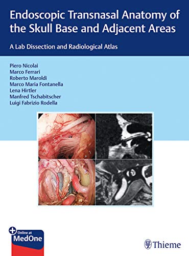 

exclusive-publishers/thieme-medical-publishers/endoscopic-transnasal-anatomy-of-the-skull-base-and-adjacent-areas--9783132415621
