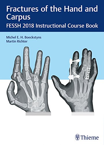 

exclusive-publishers/thieme-medical-publishers/fractures-of-the-hand-and-carpus-fessh-2018-instructional-course-book-1-e--9783132417205