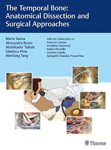 

exclusive-publishers/thieme-medical-publishers/the-temporal-bone-anatomical-dissection-and-surgical-approaches-1-e--9783132419346