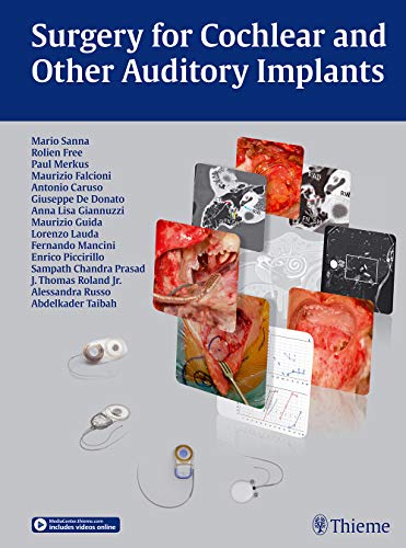 

exclusive-publishers/thieme-medical-publishers/surgery-for-cochlear-and-other-auditory-implants--9783132431904