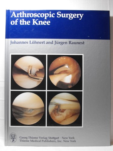 

surgical-sciences/orthopedics/arthroscopic-surgery-of-the-knee-9783137114017
