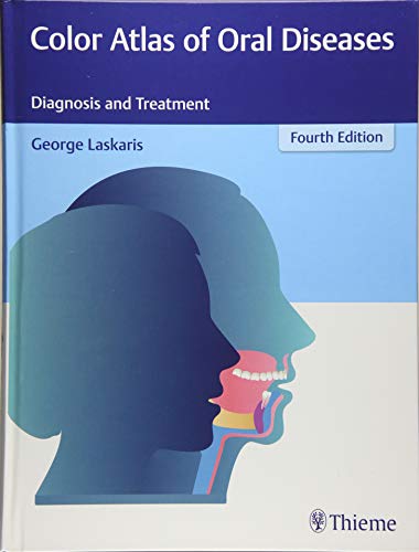 

exclusive-publishers/thieme-medical-publishers/color-atlas-of-oral-diseases-diagnosis-and-treatment-4-e--9783137170044
