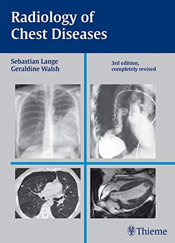 

clinical-sciences/radiology/radiology-of-chest-disesaes-3-ed-9783137407034