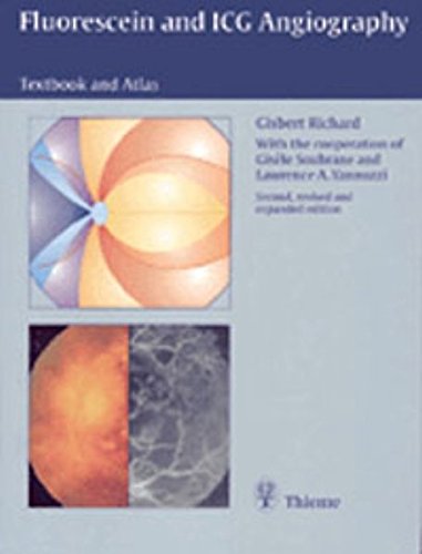 

exclusive-publishers/thieme-medical-publishers/fluorescein-angiography-textbook-and-atlas-2-ed--9783137419020