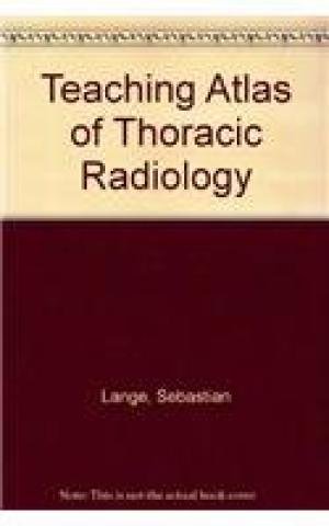 

exclusive-publishers/thieme-medical-publishers/teaching-atlas-of-thoracic-radiology-9783137917014