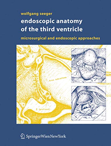 

surgical-sciences/surgery/endoscopic-anatomy-of-the-third-ventricle-9783211311776