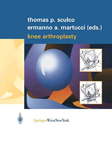 

general-books/general/-ex-knee-arthroplasty-1-ed--9783211835319