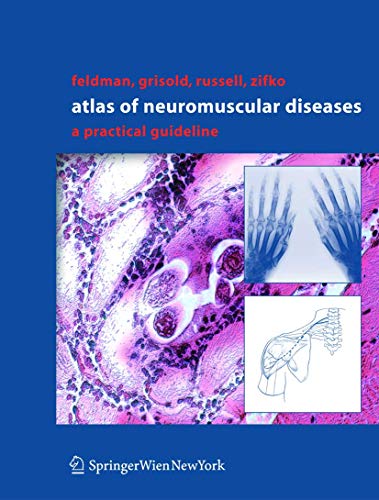 

mbbs/4-year/atlas-of-neuromuscular-diseases-a-practical-guideline-9783211838198