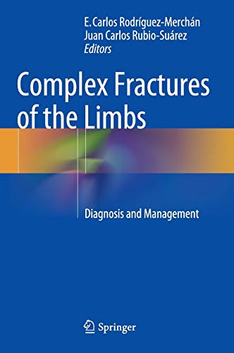 

exclusive-publishers/springer/complex-fractures-of-the-limbs-diagnosis-and-management-9783319044408