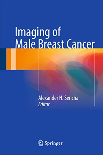 

exclusive-publishers/springer/imaging-of-male-breast-cancer-9783319060491
