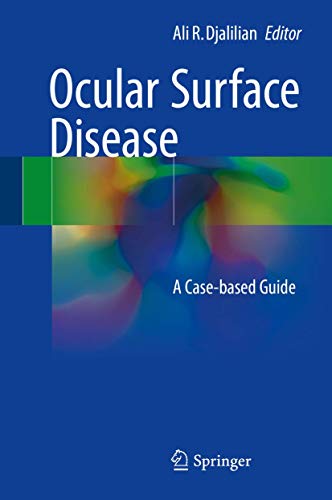 

exclusive-publishers/springer/ocular-surface-disease-a-case-based-guide--9783319158228