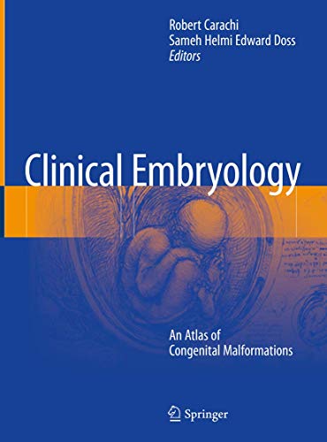 

exclusive-publishers/springer/clinical-embryology-an-atlas-of-congenital-malformations--9783319261560