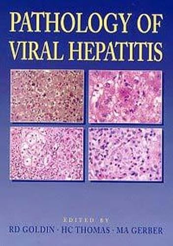 

special-offer/special-offer/pathology-of-viral-hepatitis--9780340596647