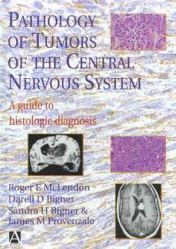 PATHOLOGY OF TUMORS OF THE CENTRAL NERVOUS SYSTEM,
