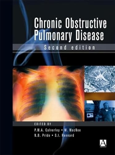 exclusive-publishers/other/chronic-obstructive-pulmonary-disease-2ed-9780340807187