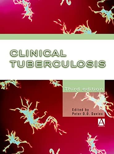 

special-offer/special-offer/clinical-tuberculosis-3-ed--9780340809167