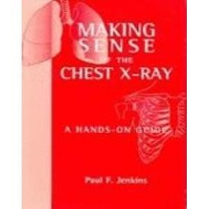 

special-offer/special-offer/making-sense-of-the-chest-x-ray-a-hands-on-guide--9780340885574