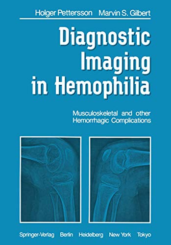 

special-offer/special-offer/diagnostic-imaging-in-hemophilia--9783540139911
