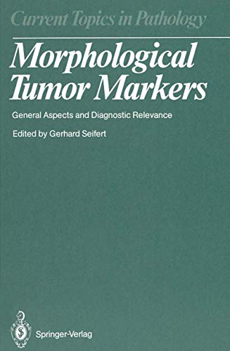 

general-books/general/current-topics-in-pathology-77-morphological-tumor-markers--9783540167334
