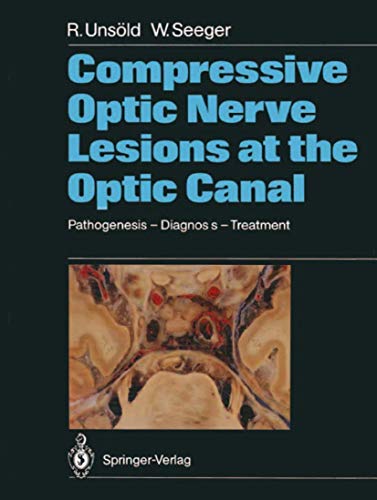 

special-offer/special-offer/compressive-optic-nerve-lesions-at-the-optic-canal-pathogenesis-diagnosis-treatment--9783540188384
