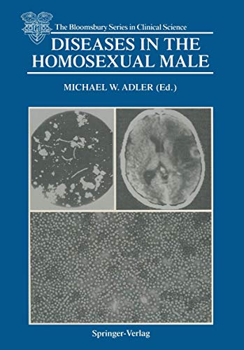 

special-offer/special-offer/diseases-in-the-homosexual-male--9783540195214
