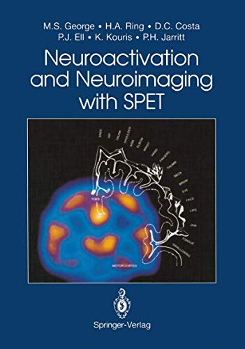 

special-offer/special-offer/neuroactivation-and-neuroimaging-with-spet--9783540197010