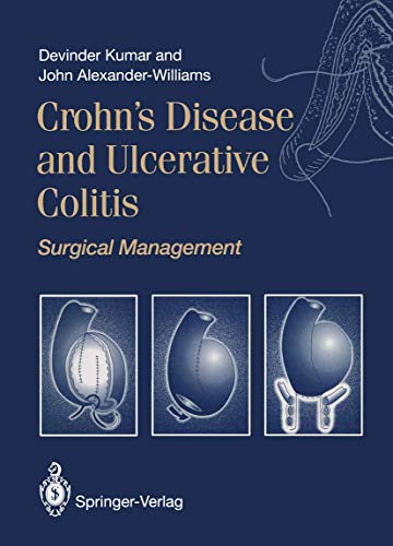

special-offer/special-offer/crohn-s-disease-and-ulcerative-colitis-surgical-management--9783540197300