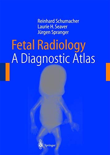 

mbbs/4-year/fetal-radiology-a-diagnostic-atlas-9783540203421