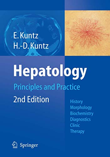 

special-offer/special-offer/hepatology-principles-practice--9783540289760
