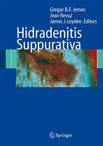 

surgical-sciences/orthopedics/hidradenitis-suppurativa-9783540331001