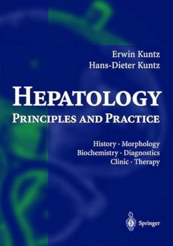 

special-offer/special-offer/hepatology-principles-and-practice--9783540421610