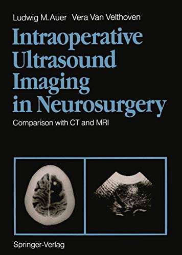 

general-books/general/intraoperative-ultrasond-imaging-in-neurosurgery-comparision-with-ct-and-mri-dm-198-eur-102--9783540502586