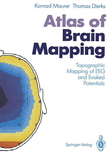 

special-offer/special-offer/atlas-of-brain-mapping--9783540530909