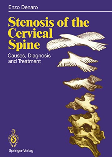 

special-offer/special-offer/stenosis-of-the-cervical-spine--9783540533283
