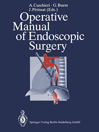 

general-books/general/operative-manual-of-endoscopic-surgery--9783540534860