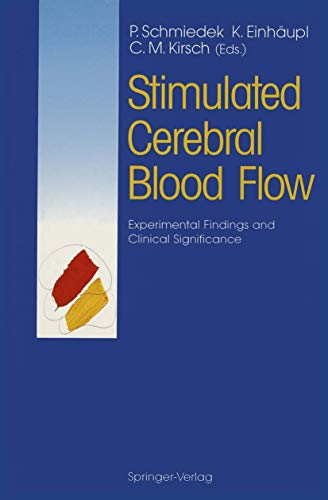 

special-offer/special-offer/stimulated-cerebral-blood-flow--9783540548263