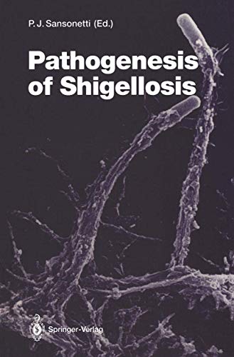 

special-offer/special-offer/pathogenesis-of-shigellosis--9783540550587