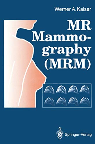 

special-offer/special-offer/mr-mammography-mrm--9783540550839