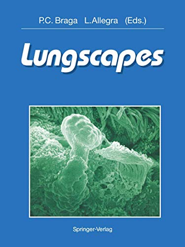 

special-offer/special-offer/lungscapes--9783540552499