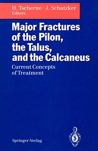 

special-offer/special-offer/major-fractures-of-the-pilon-the-talus-and-the-calcaneus--9783540558378