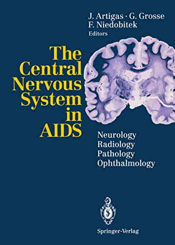 

special-offer/special-offer/the-central-nervous-system-in-aids--9783540558392