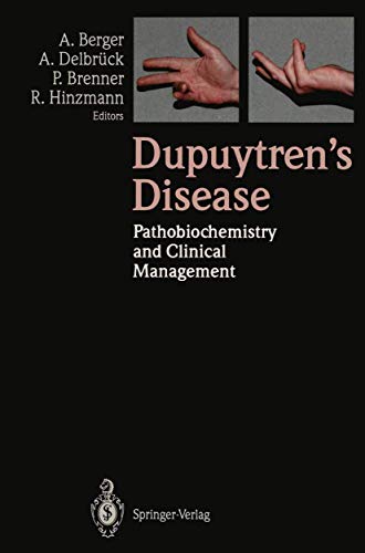 

special-offer/special-offer/dupuytren-s-disease-pathobiochemistry-and-clinical-management--9783540572398