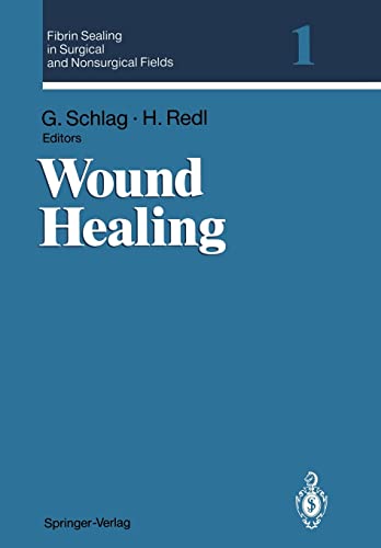

general-books/general/wound-healing--9783540575115