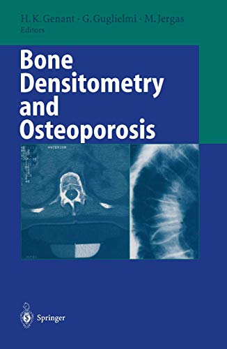 

general-books/general/bone-densitometry-and-osteoporosis--9783540631491