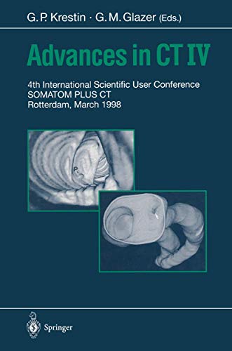 

special-offer/special-offer/advances-in-ct-iv-4th-international-scientific-user-conference-somatom-plus-ct-rotterdam-march-1998--9783540643487