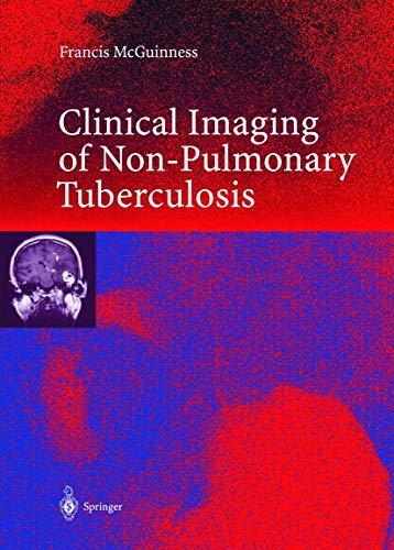 

mbbs/4-year/clinical-imaging-in-non-pulmonary-tuberculosis-9783540659402