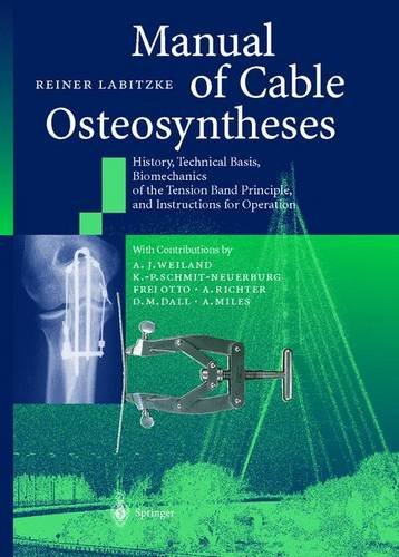 

mbbs/4-year/manual-of-cable-osteosyntheses-9783540665083