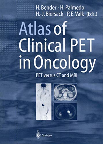 

general-books/general/atlas-of-clinical-pet-in-oncology--9783540667261