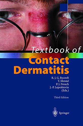 

exclusive-publishers/springer/textbook-of-contact-dermatitis--9783540668428