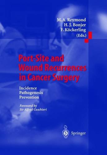 

exclusive-publishers/springer/port-site-and-wound-recurrences-in-cancer-surgery--9783540669296